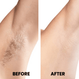 Sonax Pro™ Epilator | Hair-Free