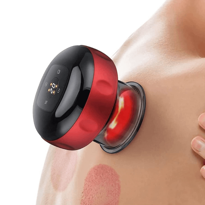 Electric Cupping Therapy | Muscle Relief